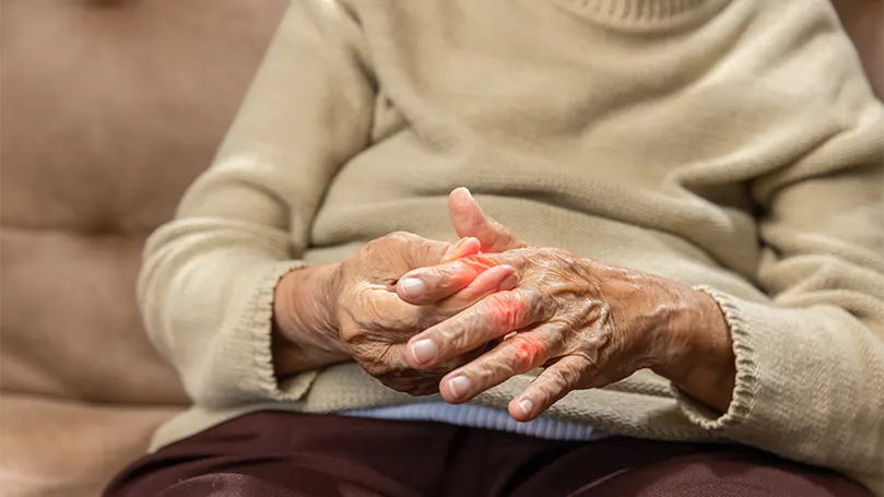 Image d'une femme âgée souffrant d'arthrite rhumatoïde.
