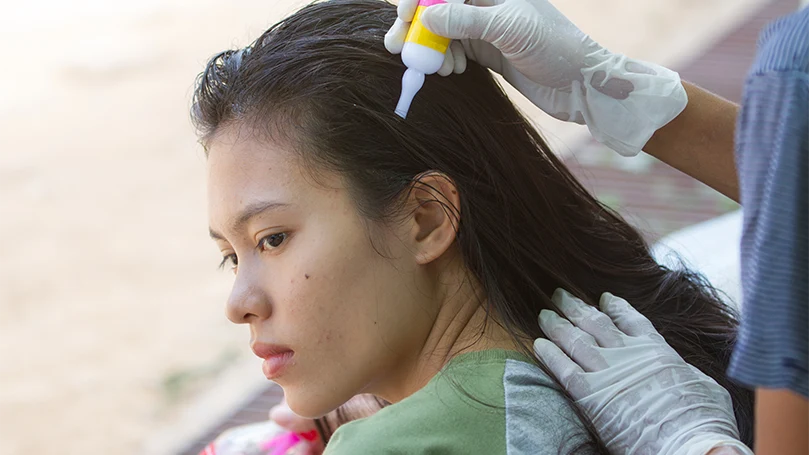 Image d'une femme utilisant un traitement contre les poux pour ses cheveux.