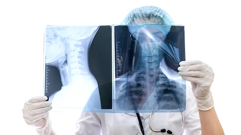 Image d'un médecin examinant la radiographie d'un patient et une fracture par compression.