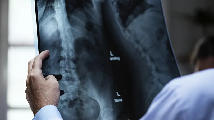 Image d'un médecin examinant une radiographie.
